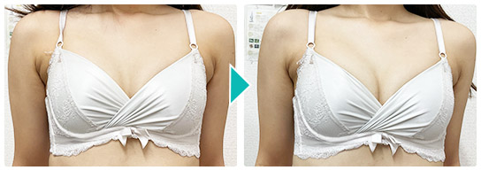 バストアップ・育乳整体 バストアップ・育乳整体